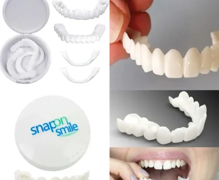 Snap-On Smile: Výhody, Hodnocení Uživatelů