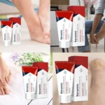 Keramin Krém: protiplísňový krém na nohy