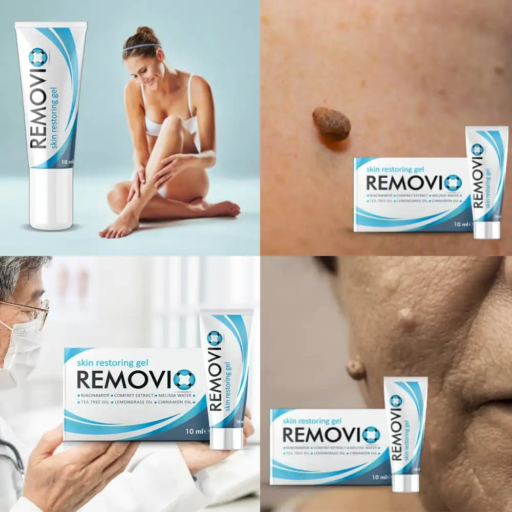 Výrobek Removio: Ultimátní řešení pro HPV bradavice